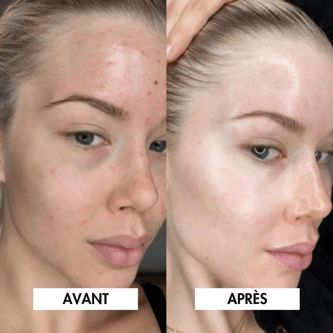 4 Masques Bio-Collagène