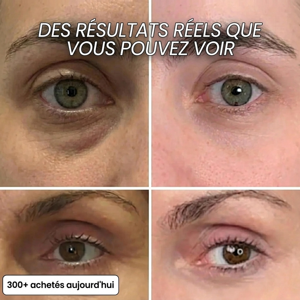 Stick Repulpant Bio-Collagène