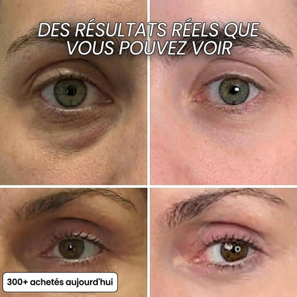 Stick Repulpant Bio-Collagène