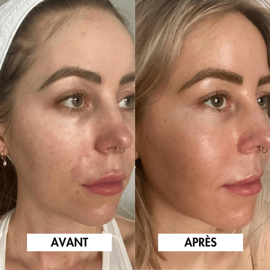 4 Masques Bio-Collagène