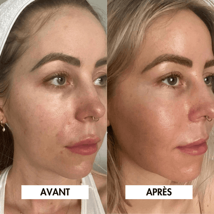 4 Masques Bio-Collagène