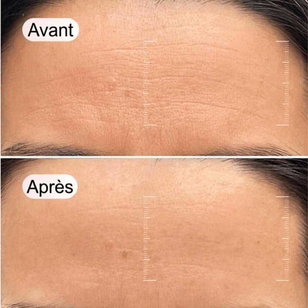Éclat Collagène