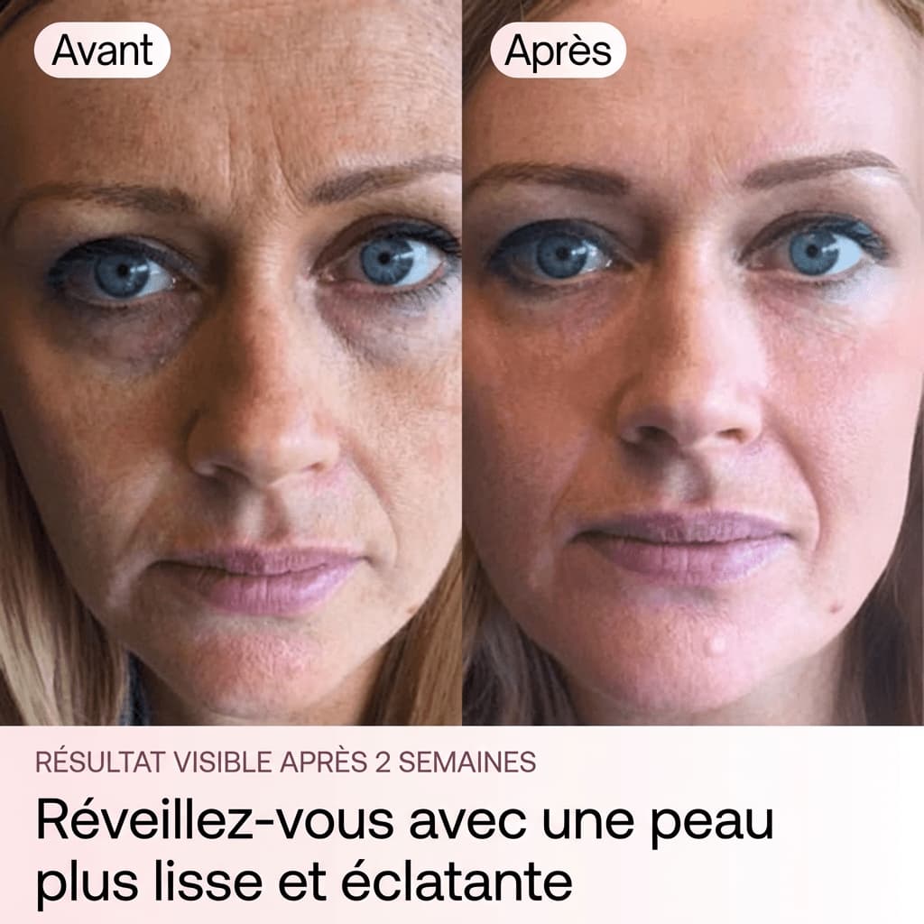 Éclat Collagène